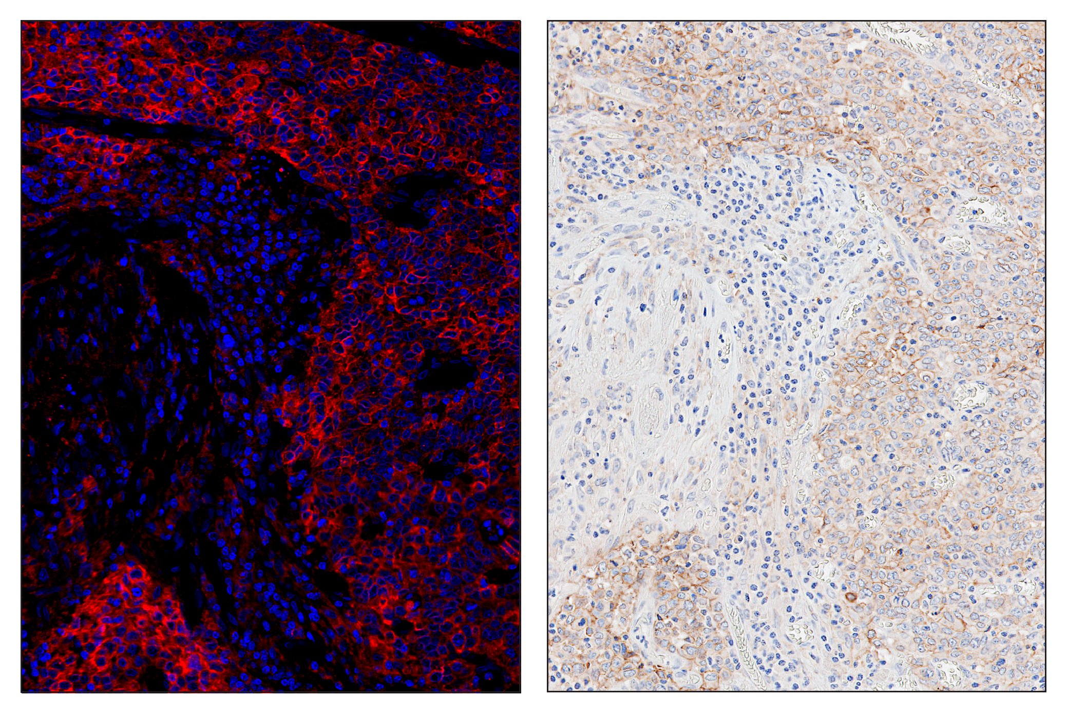 Immunohistochemistry Image 5: PD-L1 (E1L3N®) & CO-0005-647 SignalStar™ Oligo-Antibody Pair