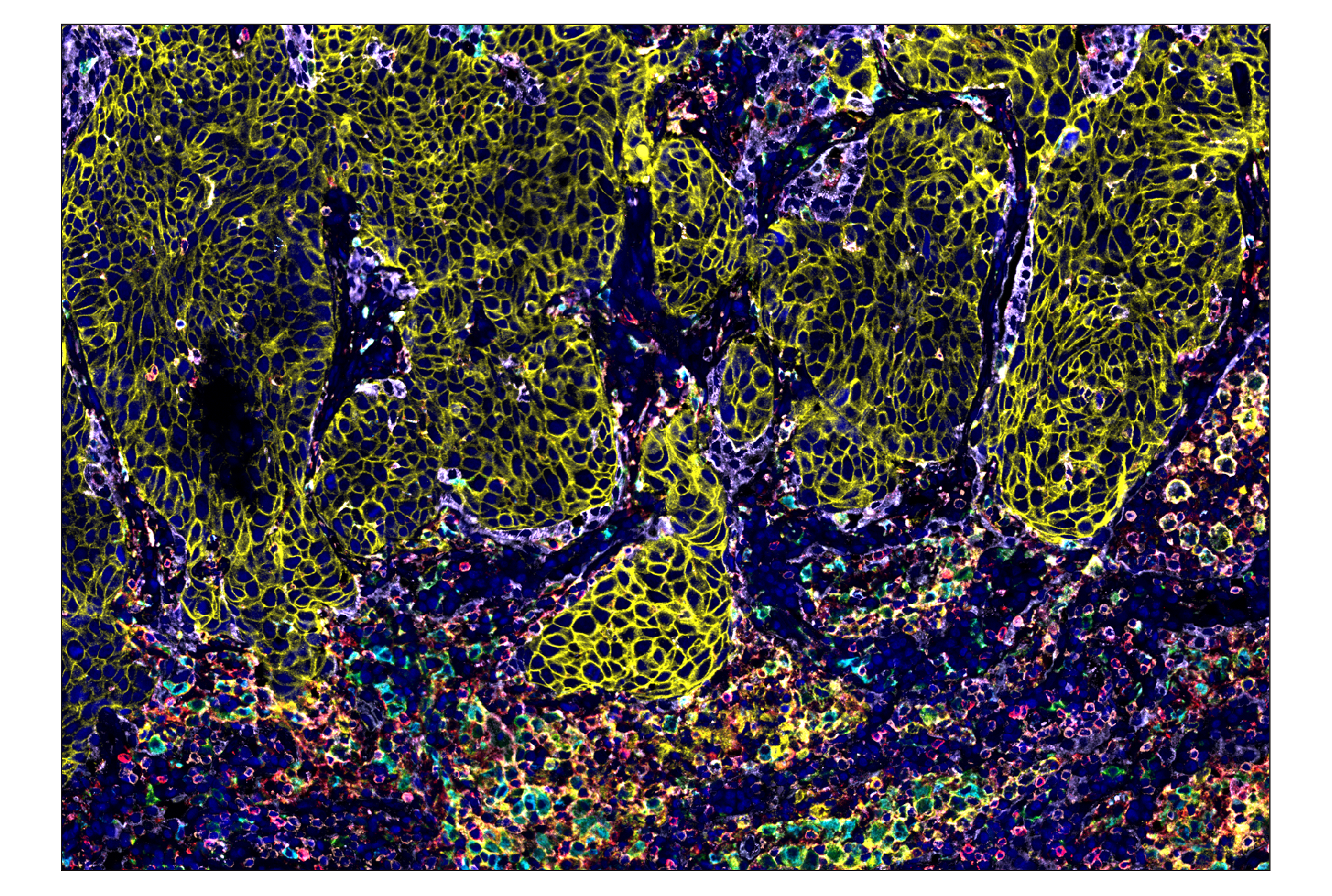 Immunohistochemistry Image 1: PD-L1 (E1L3N®) & CO-0005-488 SignalStar™ Oligo-Antibody Pair