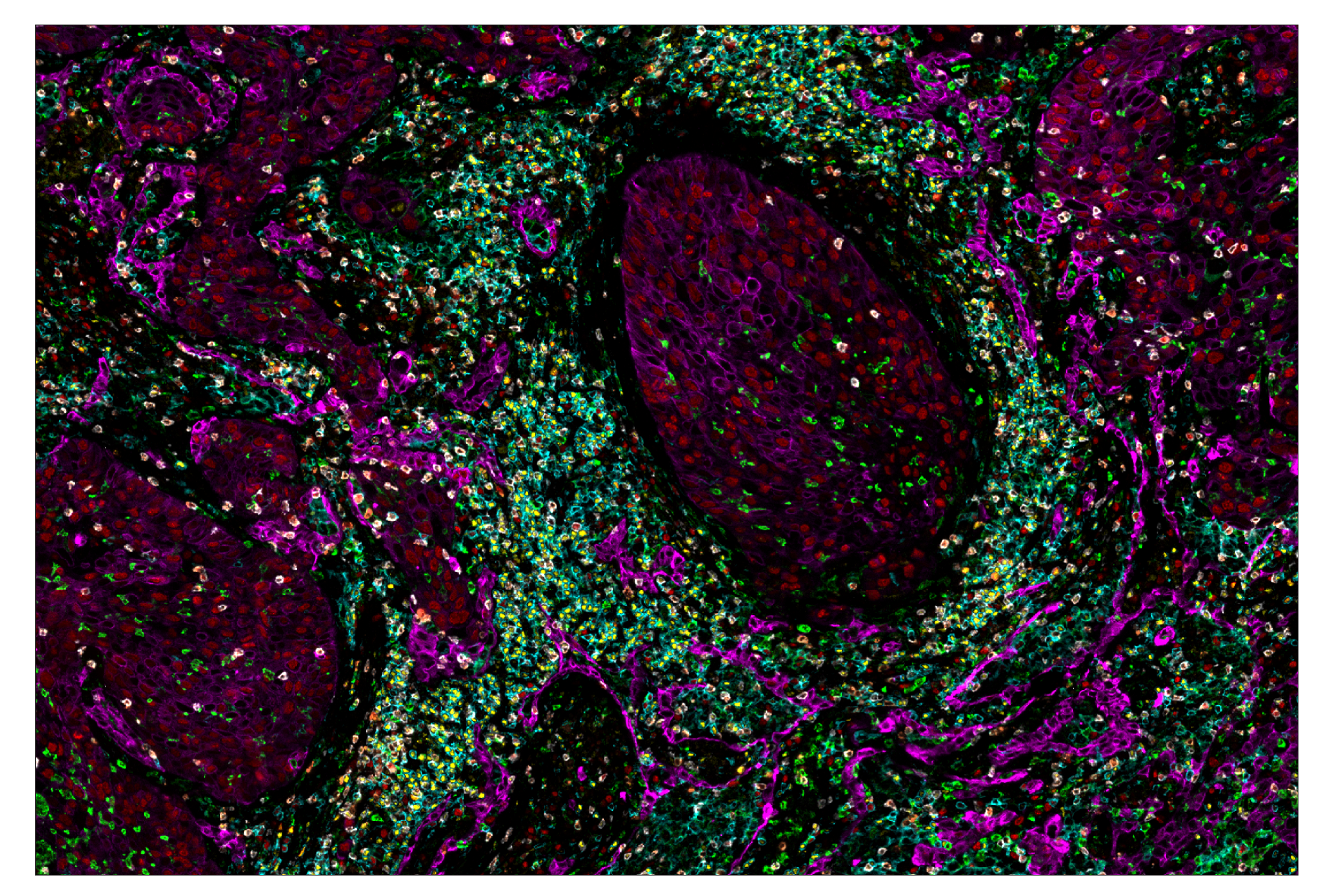 Immunohistochemistry Image 1: CD4 (MSVA-004R) & CO-0071-647 SignalStar™ Oligo-Antibody Pair