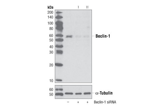  Image 1: SignalSilence® Beclin-1 siRNA II