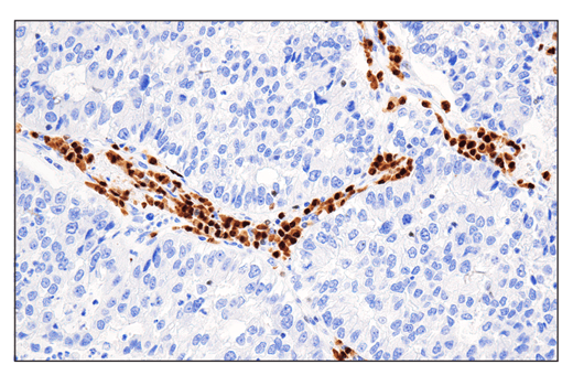 Immunohistochemistry Image 1: IRF-4 (E8H3S) XP® Rabbit mAb (BSA and Azide Free)