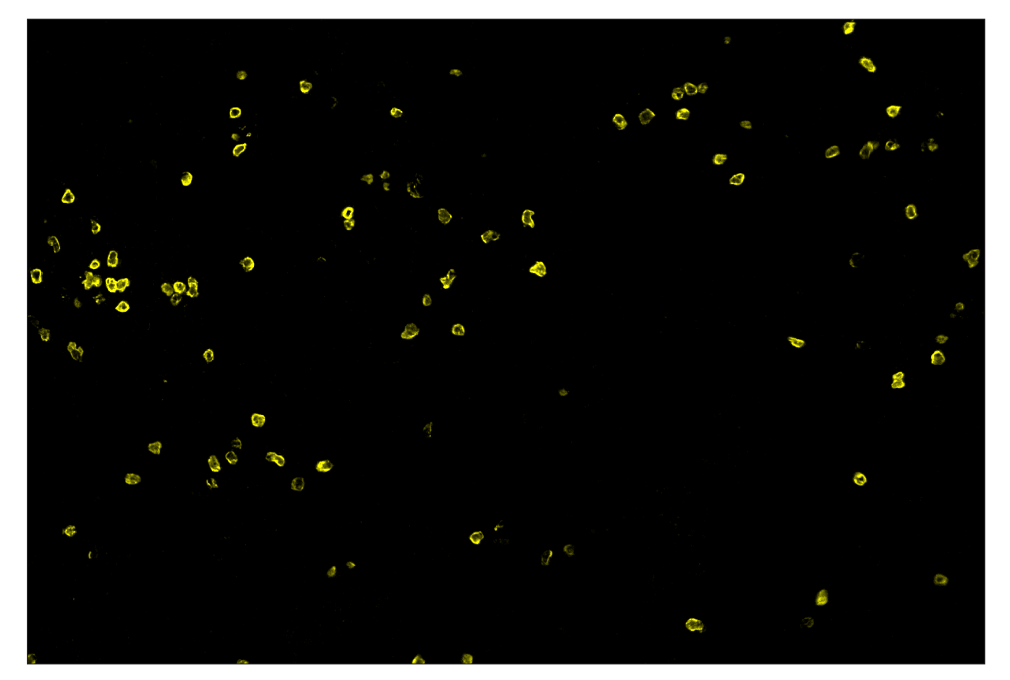 Immunohistochemistry Image 3: CD3ε (E4T1B) & CO-0048-647 SignalStar™ Oligo-Antibody Pair