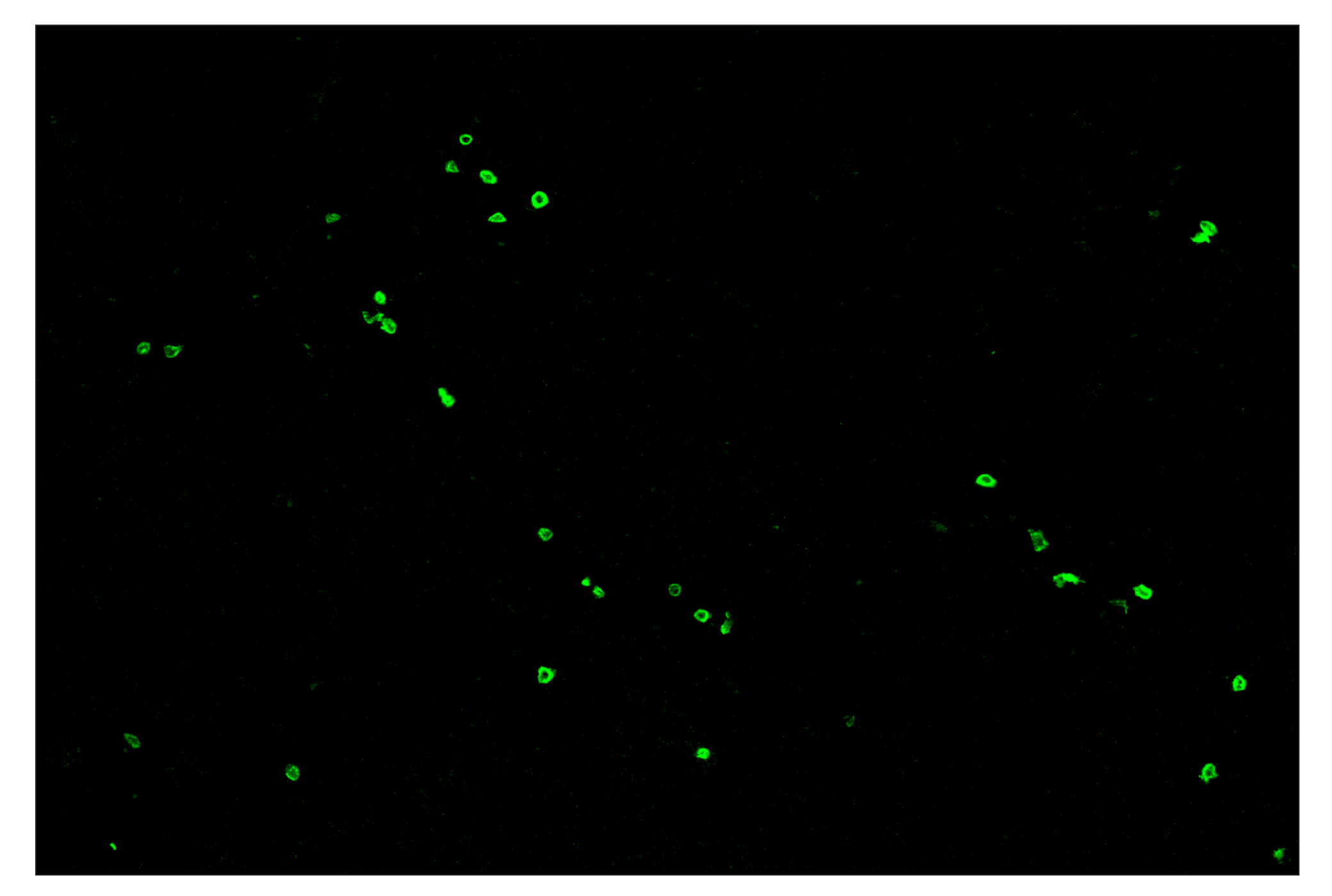 Immunohistochemistry Image 2: CD3ε (E4T1B) & CO-0048-594 SignalStar™ Oligo-Antibody Pair