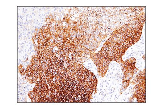 Immunohistochemistry Image 1: CD47 (D3O7P) Rabbit mAb