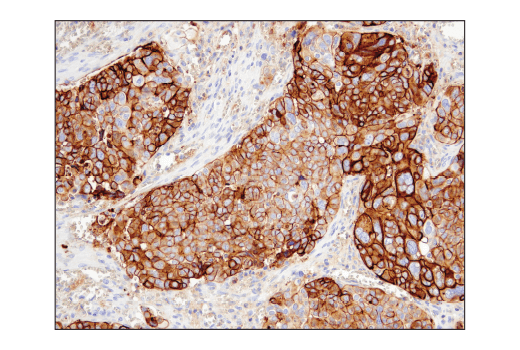 Immunohistochemistry Image 7: CD47 (D3O7P) Rabbit mAb