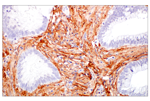  Image 40: Extracellular Matrix Dynamics Antibody Sampler Kit