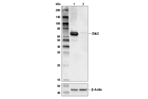  Image 12: Phospho-Chk1/2 Antibody Sampler Kit