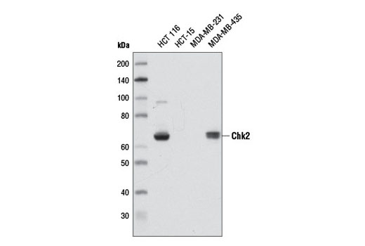  Image 5: PhosphoPlus® Chk2 (Thr68) Antibody Duet