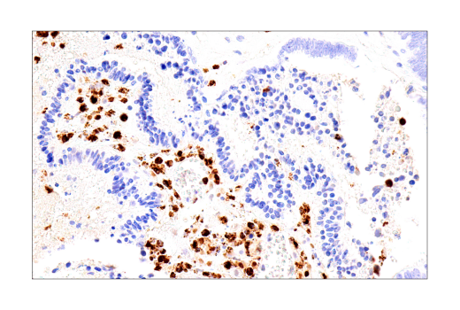  Image 37: NETosis Antibody Sampler Kit