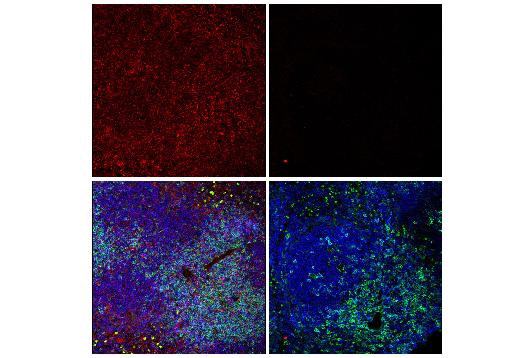 Immunofluorescence Image 1: β2-microglobulin (E8G2O) Rabbit mAb
