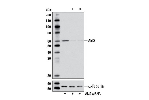  Image 1: SignalSilence® Akt2 siRNA I (Mouse Specific)