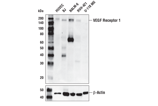 Western Blotting Image 1: VEGF Receptor 1 (E7T9H) Rabbit mAb