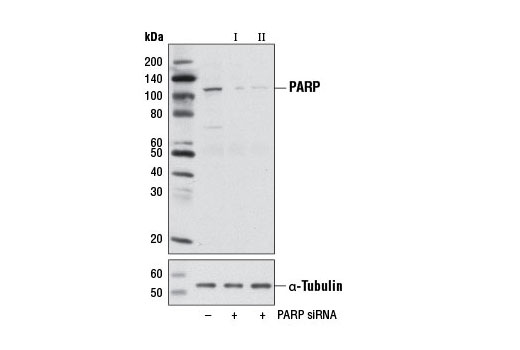  Image 1: SignalSilence® PARP siRNA II (Mouse Specific)