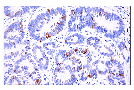 Immunohistochemistry Image 2: Phospho-Chk2 (Thr68) (E8Q1A) Rabbit mAb (BSA and Azide Free)