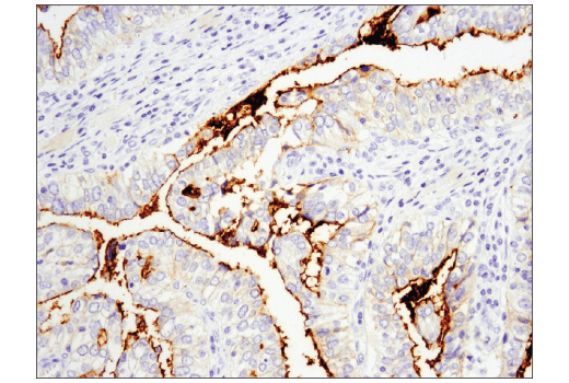 Immunohistochemistry Image 1: CD133 (D2V8Q) XP® Rabbit mAb