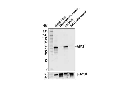 Western Blotting Image 1: ABAT Antibody