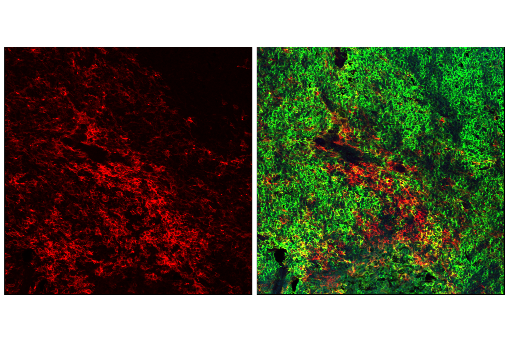 Immunofluorescence Image 2: CD11c (D1V9Y) Rabbit mAb (Alexa Fluor® 555 Conjugate)