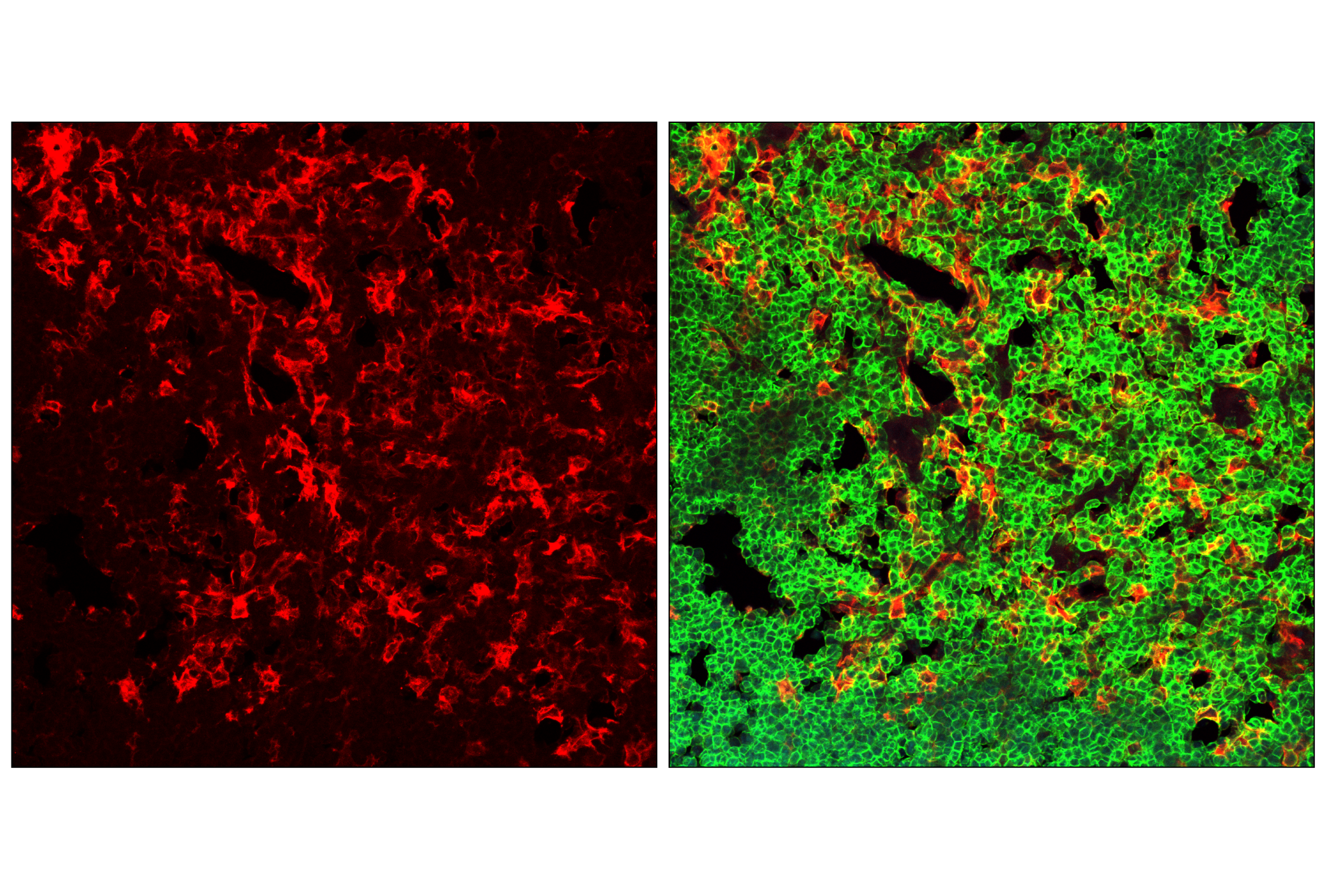 Immunofluorescence Image 1: CD11c (D1V9Y) Rabbit mAb (Alexa Fluor® 555 Conjugate)
