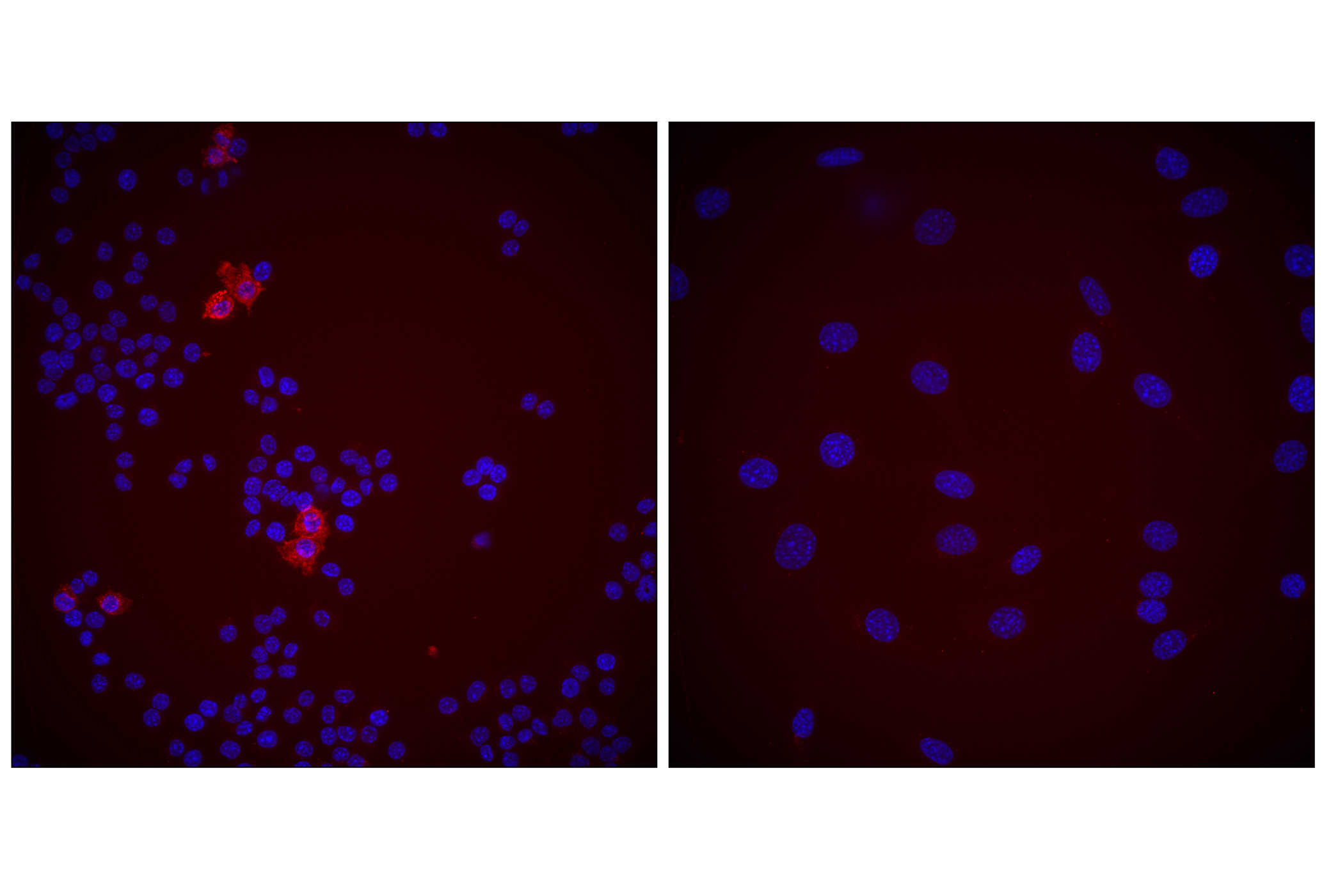 Immunofluorescence Image 4: CD11c (D1V9Y) Rabbit mAb (Alexa Fluor® 555 Conjugate)