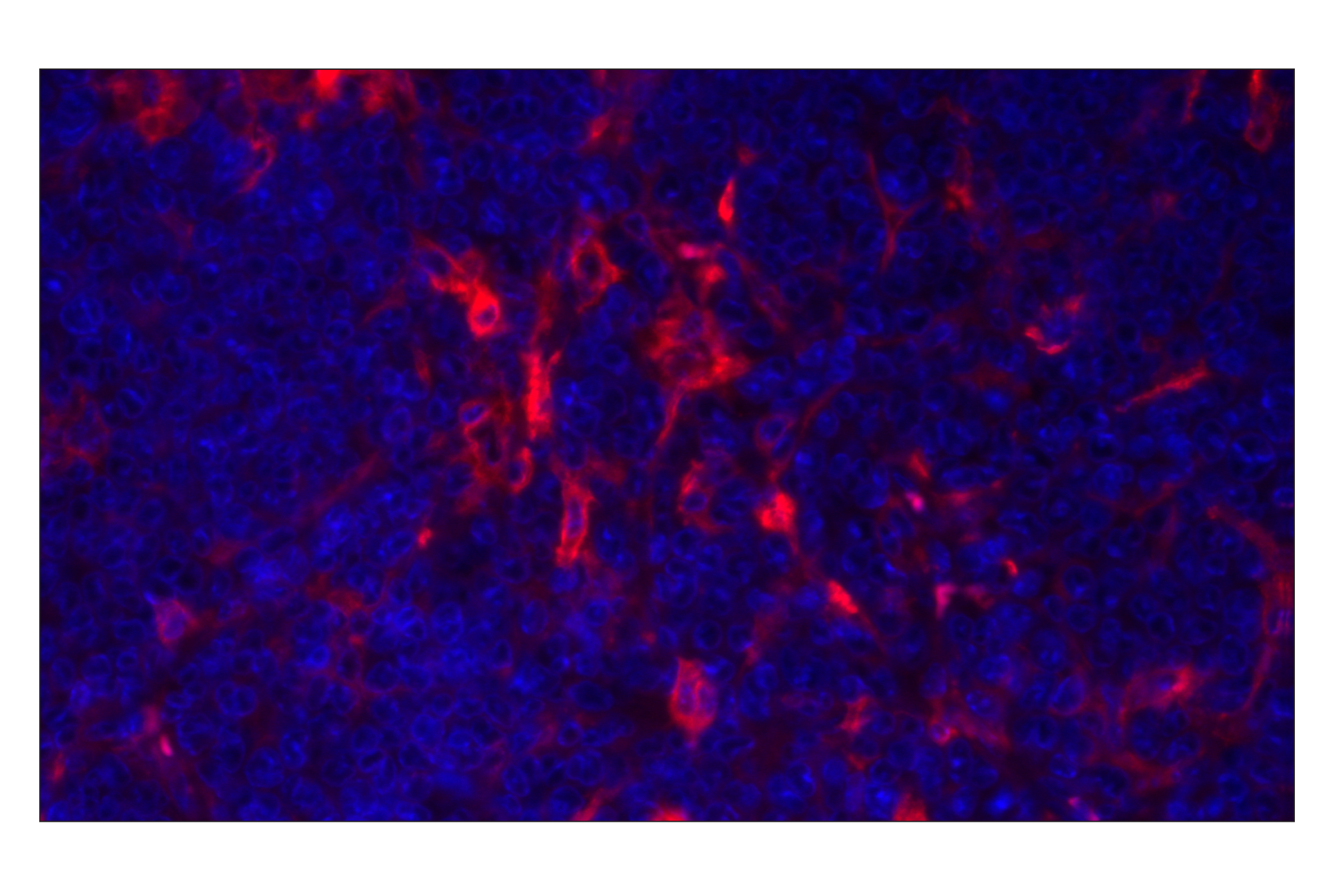 Immunohistochemistry Image 1: CD11c (D1V9Y) Rabbit mAb (Alexa Fluor® 555 Conjugate)