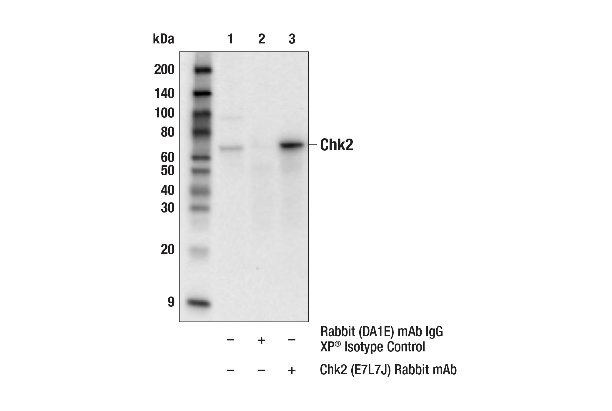 Immunoprecipitation Image 1: Chk2 (E7L7J) Rabbit mAb