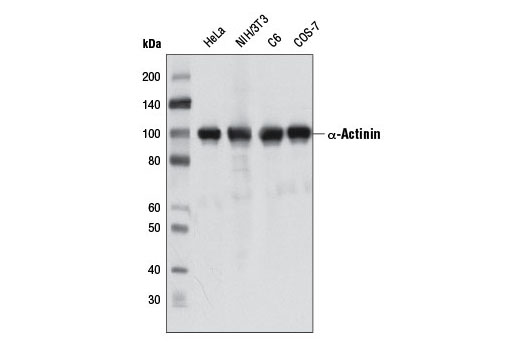 Western Blotting Image 1: α-Actinin (D6F6) XP® Rabbit mAb