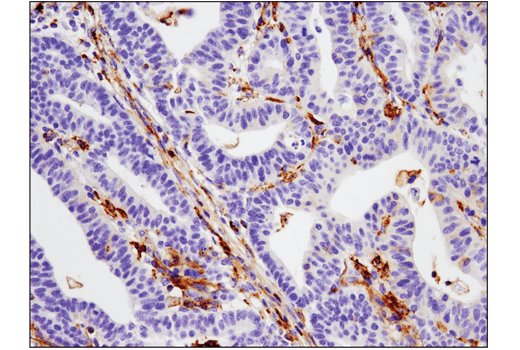 Immunohistochemistry Image 1: VISTA (D1L2G™) XP® Rabbit mAb