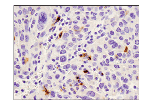 Immunohistochemistry Image 5: PD-L1 (D5V3B) Rabbit mAb (Mouse Specific; IHC Specific)