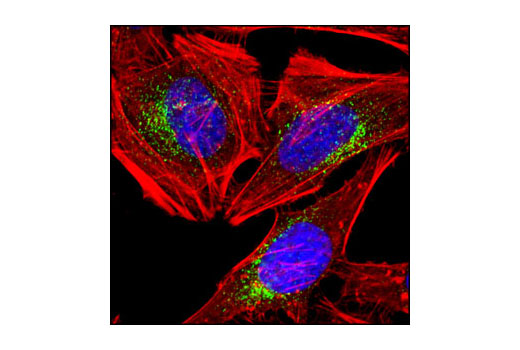 Immunofluorescence Image 4: EEA1 (C45B10) Rabbit mAb (BSA and Azide Free)