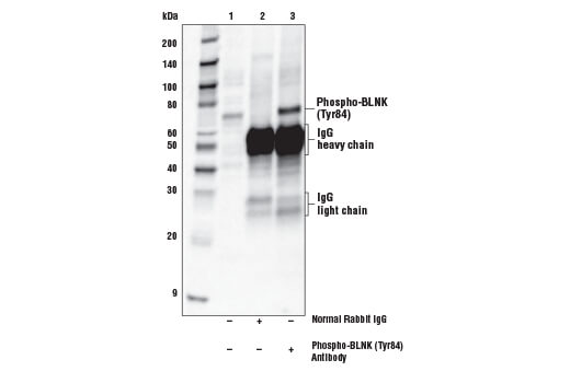 Immunoprecipitation Image 1: Phospho-BLNK (Tyr84) Antibody