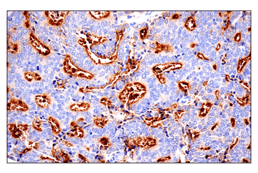 Immunohistochemistry Image 9: CD10/Neprilysin (E5P7S) Rabbit mAb