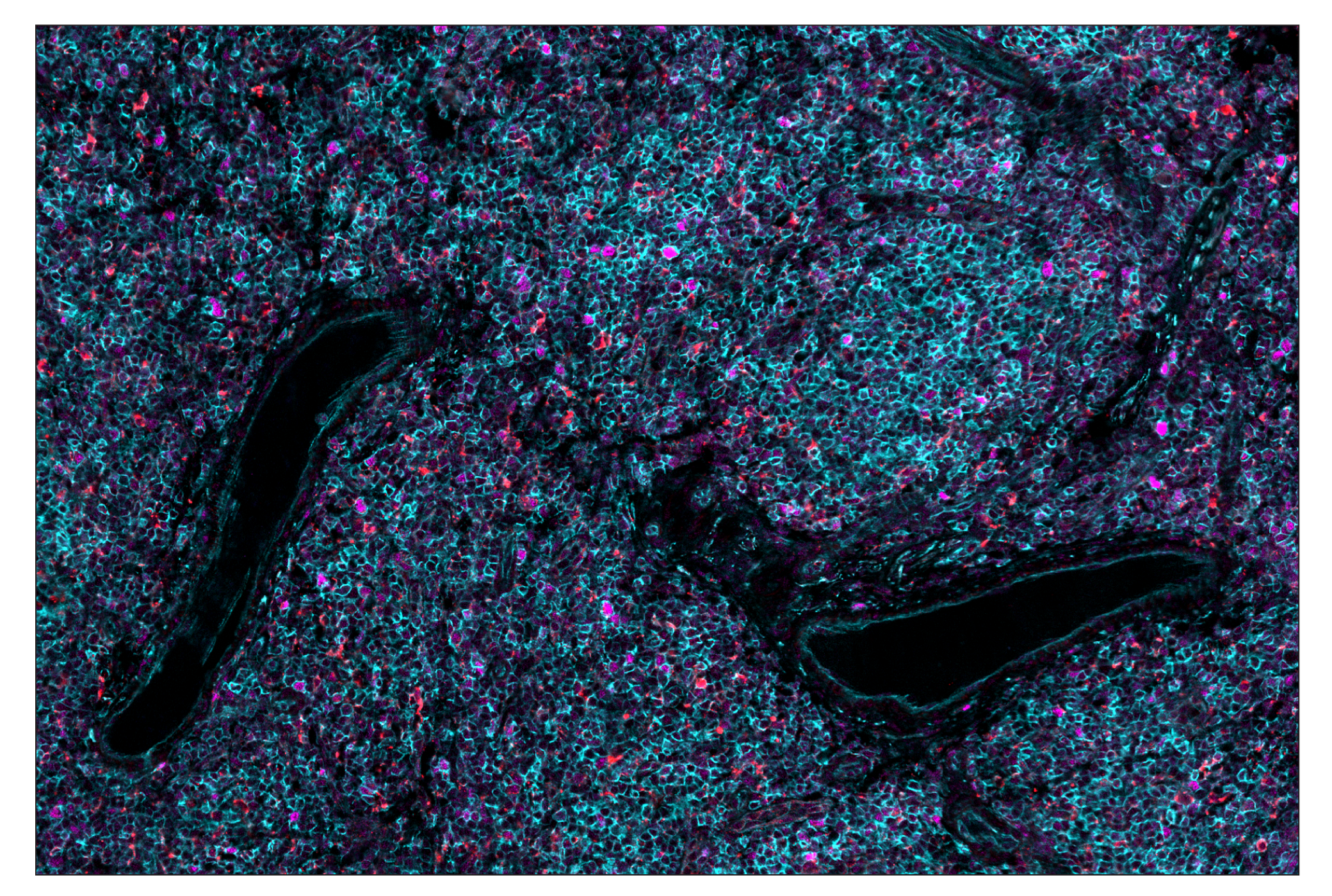 Immunohistochemistry Image 8: OX40L (D6K7R) & CO-0087-750 SignalStar™ Oligo-Antibody Pair