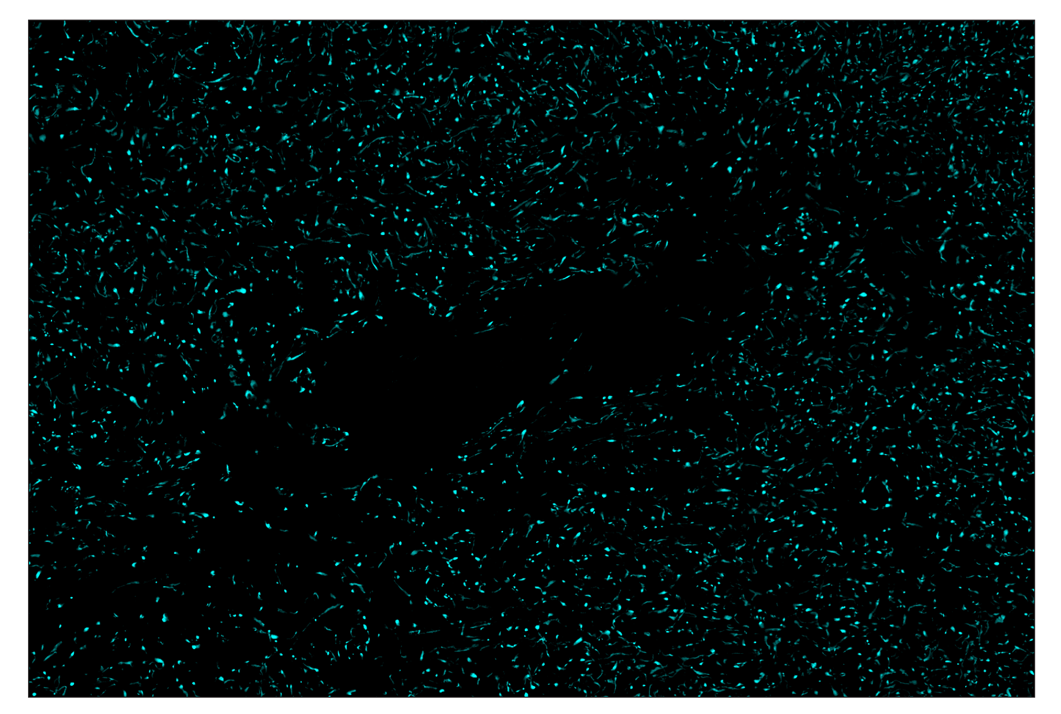 Immunohistochemistry Image 5: OX40L (D6K7R) & CO-0087-750 SignalStar™ Oligo-Antibody Pair