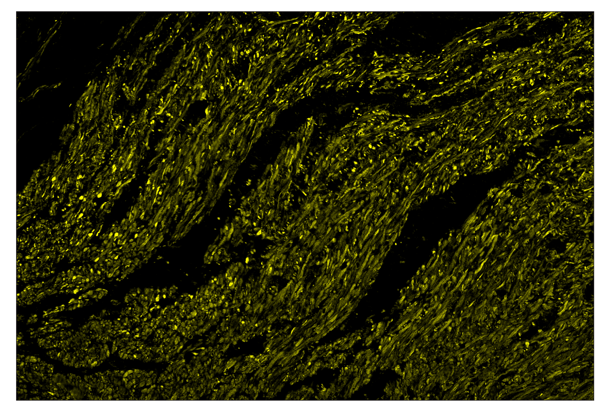 Immunohistochemistry Image 3: OX40L (D6K7R) & CO-0087-750 SignalStar™ Oligo-Antibody Pair