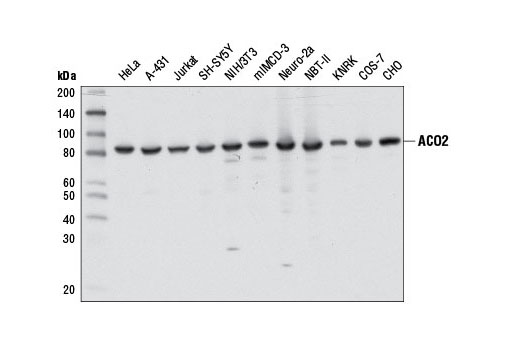  Image 9: Tricarboxylic Acid Cycle Antibody Sampler Kit