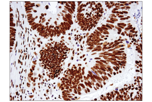  Image 43: BAF Complex IHC Antibody Sampler Kit