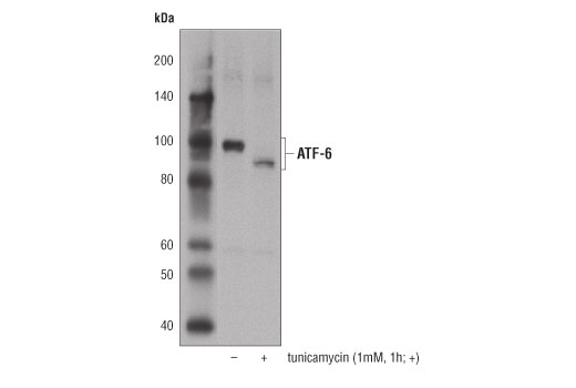  Image 9: ER Homeostasis Antibody Sampler Kit