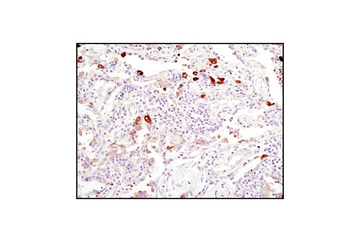 Immunohistochemistry Image 3: Fatty Acid Synthase (C20G5) Rabbit mAb (BSA and Azide Free)