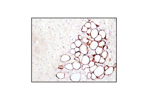 Immunohistochemistry Image 4: Fatty Acid Synthase (C20G5) Rabbit mAb (BSA and Azide Free)
