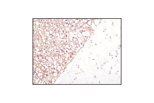 Immunohistochemistry Image 5: Fatty Acid Synthase (C20G5) Rabbit mAb (BSA and Azide Free)