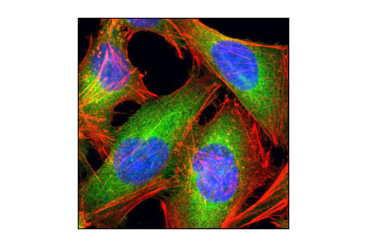 Immunofluorescence Image 1: Fatty Acid Synthase (C20G5) Rabbit mAb (BSA and Azide Free)