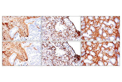 Immunohistochemistry Image 11: COL1A1 (E3E1X) Mouse mAb (BSA and Azide Free)