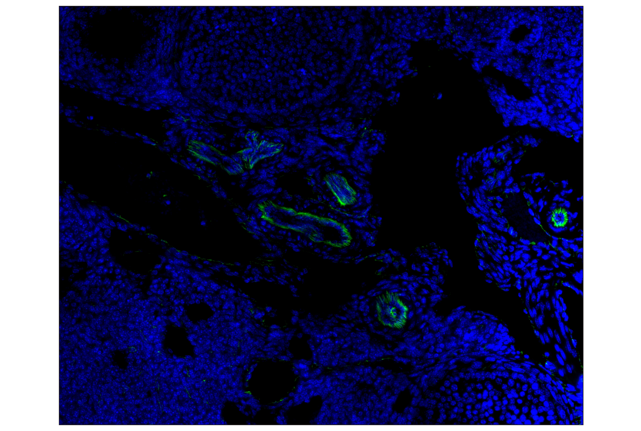 Immunohistochemistry Image 1: CD31 (PECAM-1) (D8V9E) XP® Rabbit mAb (Alexa Fluor® 488 Conjugate)
