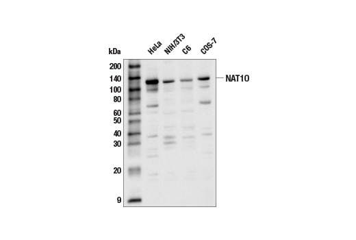 Western Blotting Image 1: NAT10 Antibody