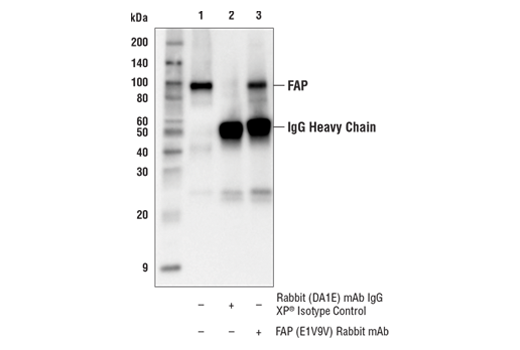  Image 17: Cancer Associated Fibroblast Marker Antibody Sampler Kit