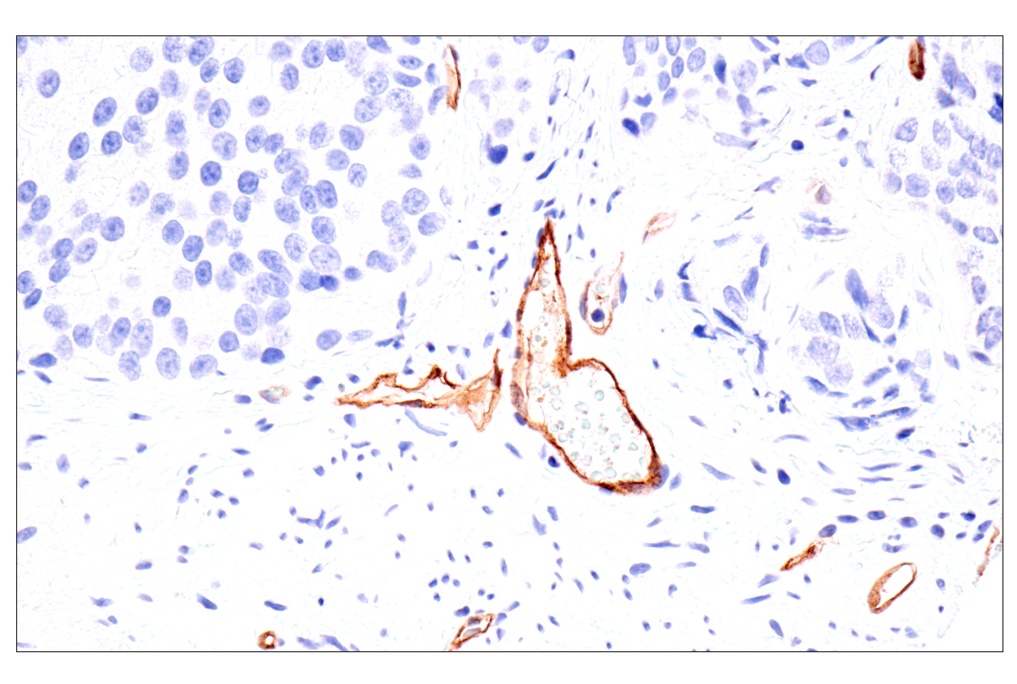 Immunohistochemistry Image 4: Claudin-5 (E5D9Y) Rabbit mAb