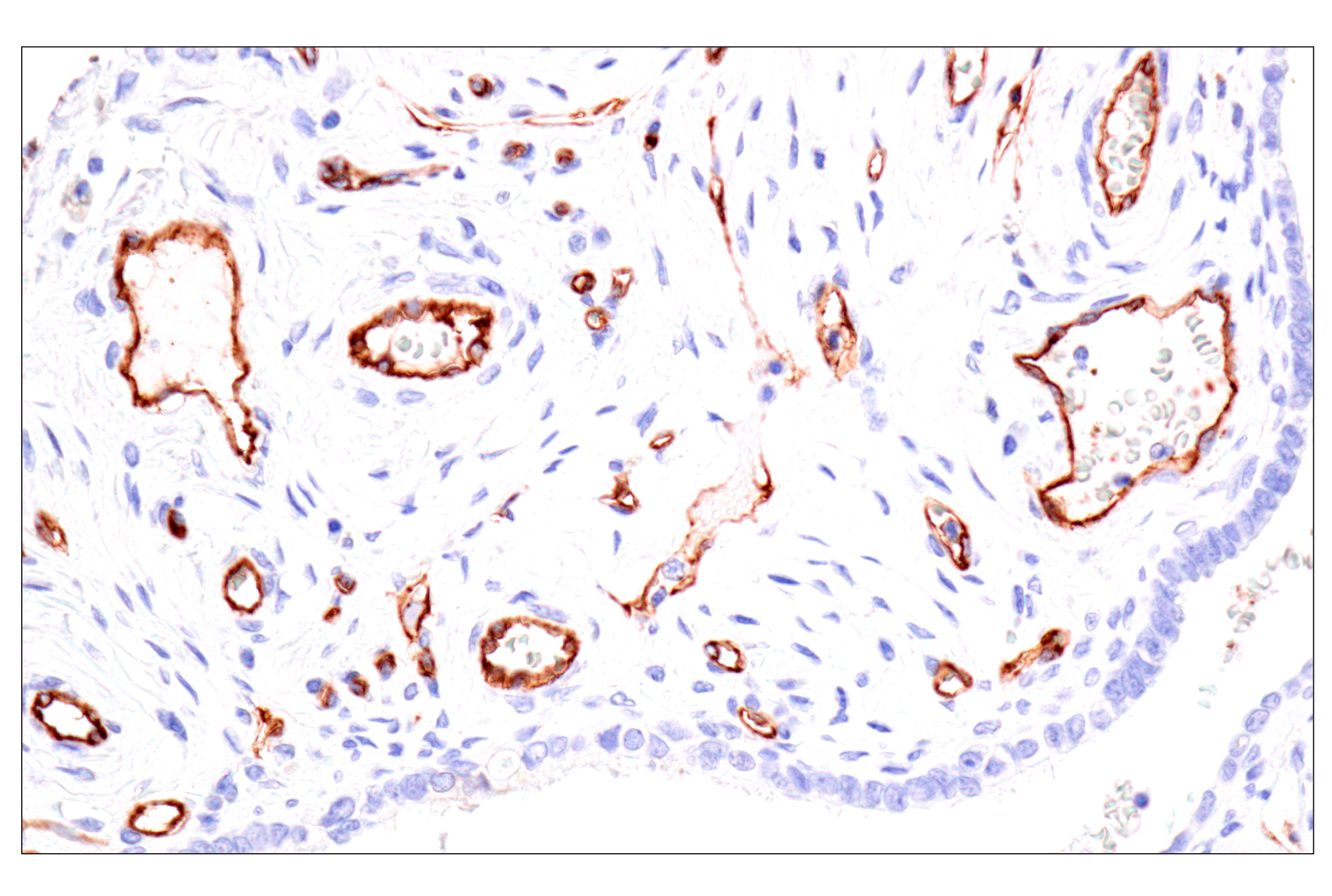 Immunohistochemistry Image 2: Claudin-5 (E5D9Y) Rabbit mAb