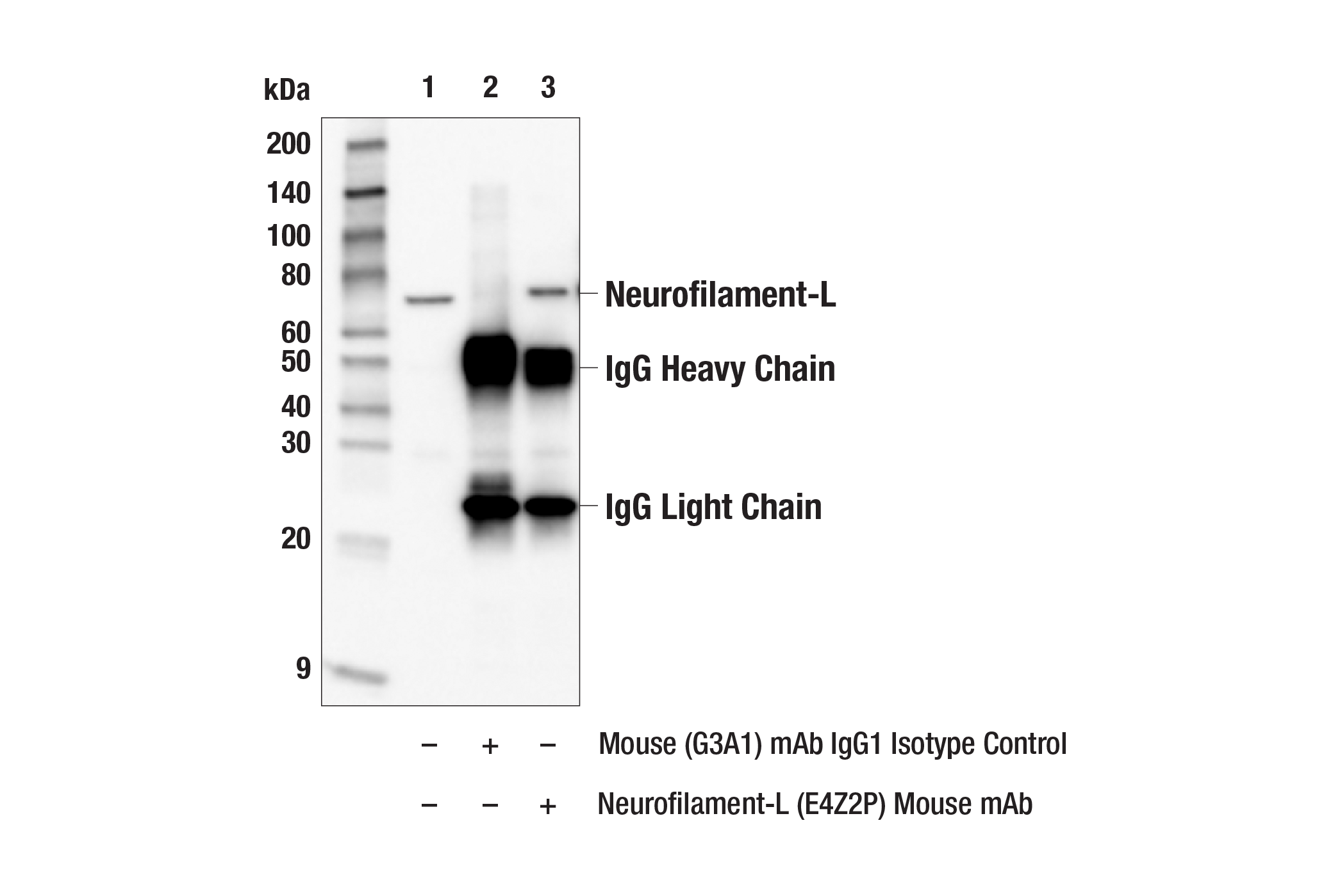 Immunoprecipitation Image 2: Neurofilament-L (E4Z2P) Mouse mAb