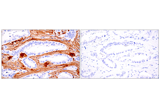 Immunohistochemistry Image 10: COL1A1 (E3E1X) Mouse mAb