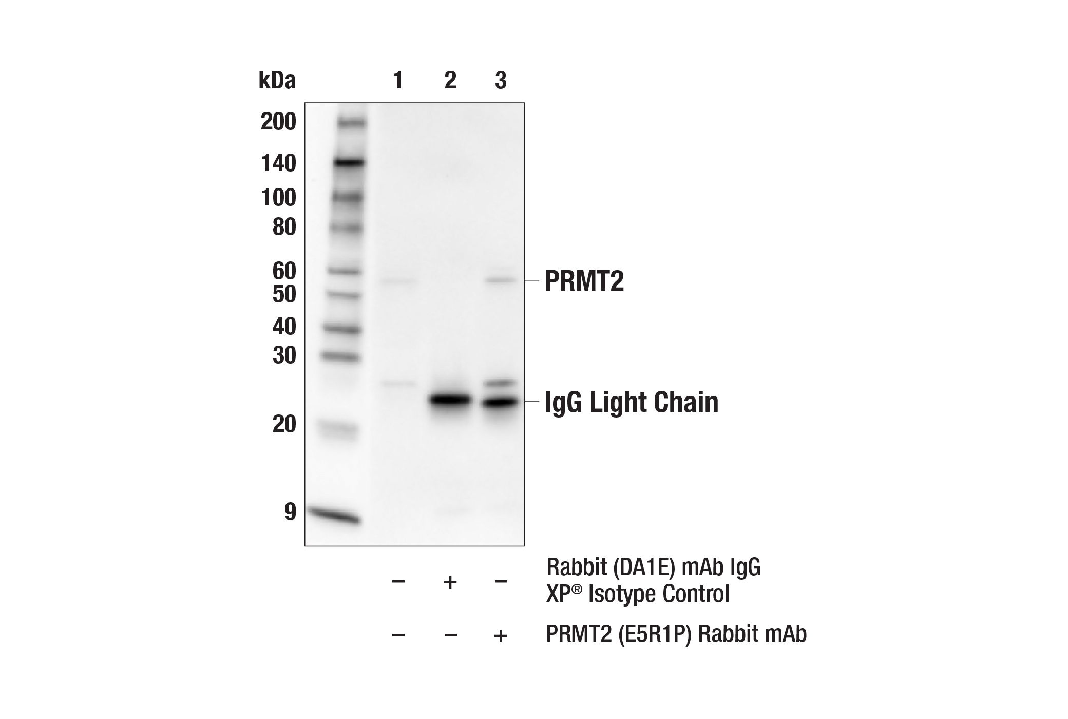Immunoprecipitation Image 1: PRMT2 (E5R1P) Rabbit mAb